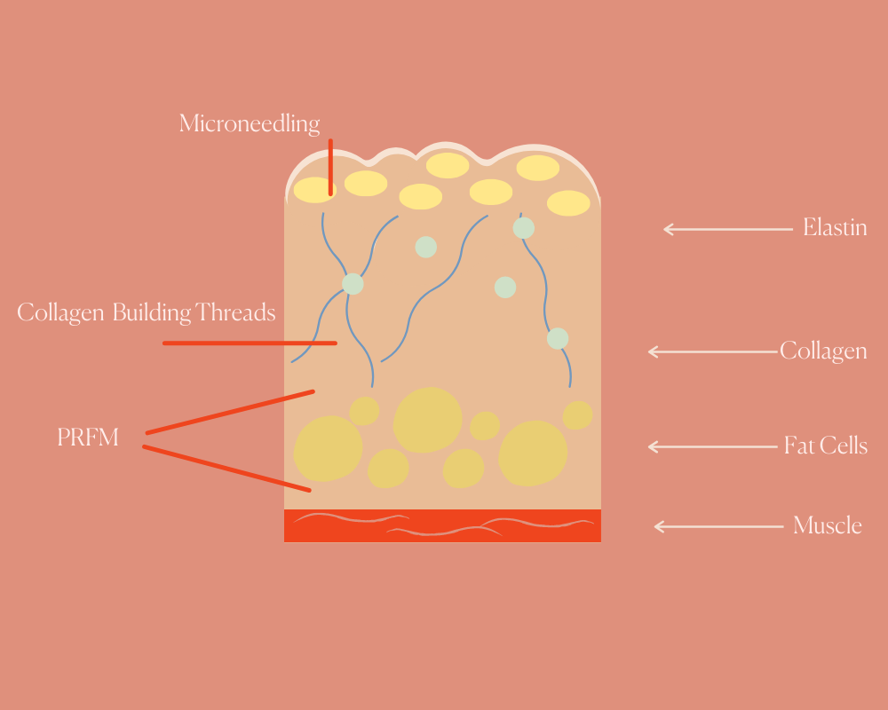 3 Bio Regenerative Treatments that Build Collagen – The Things We Do Beauty