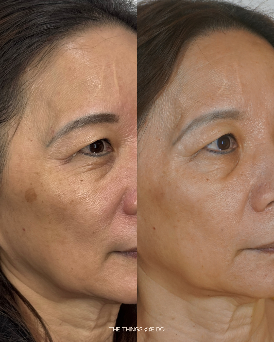 Face (3 sessions)